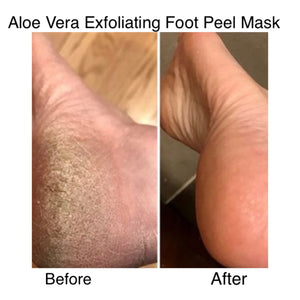 Aloe Vera Exfoliating Foot Peel Mask